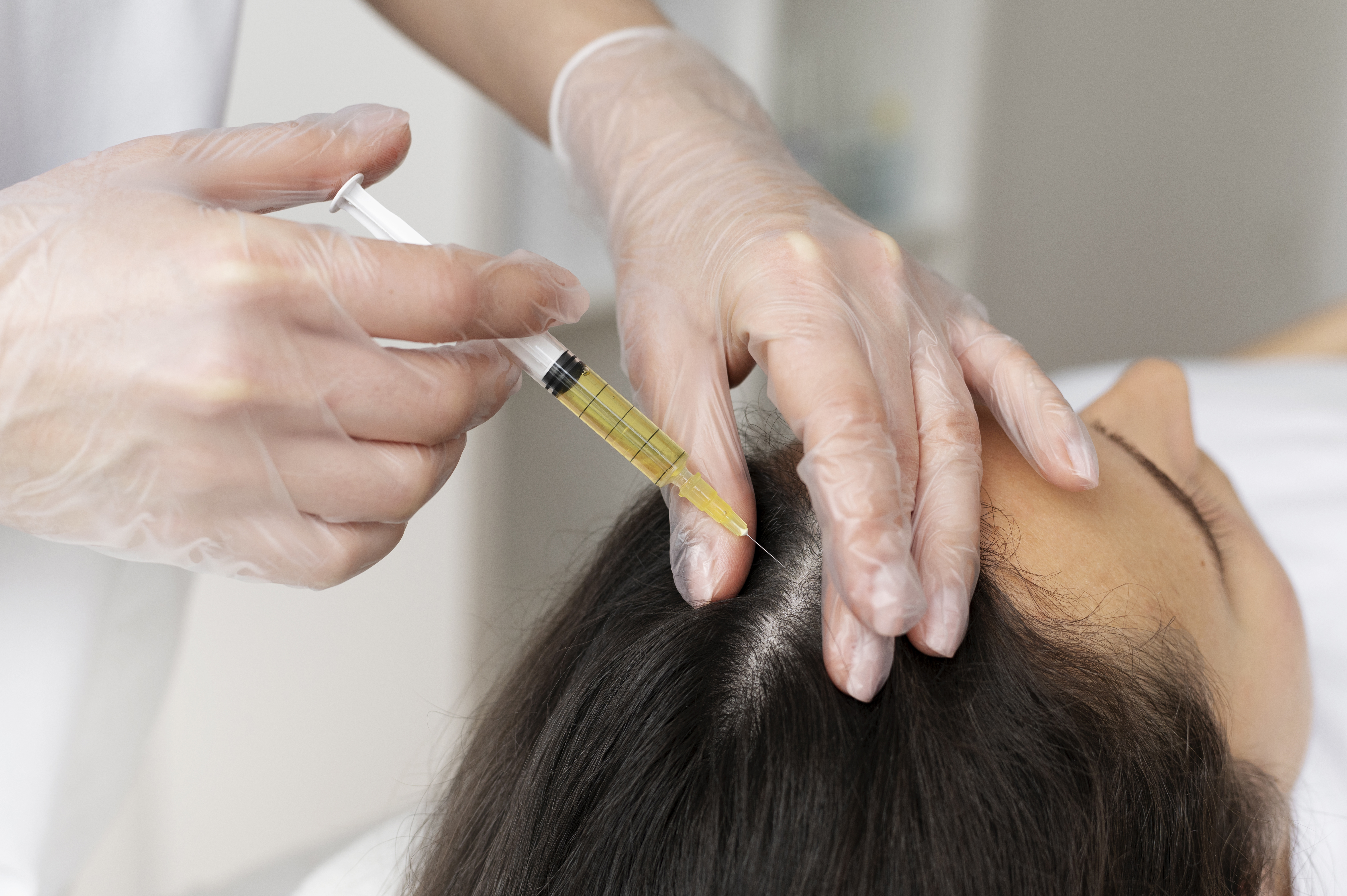 PRP Treatment for Hair and Skin: Why Looklush is Trusted in Gurgaon