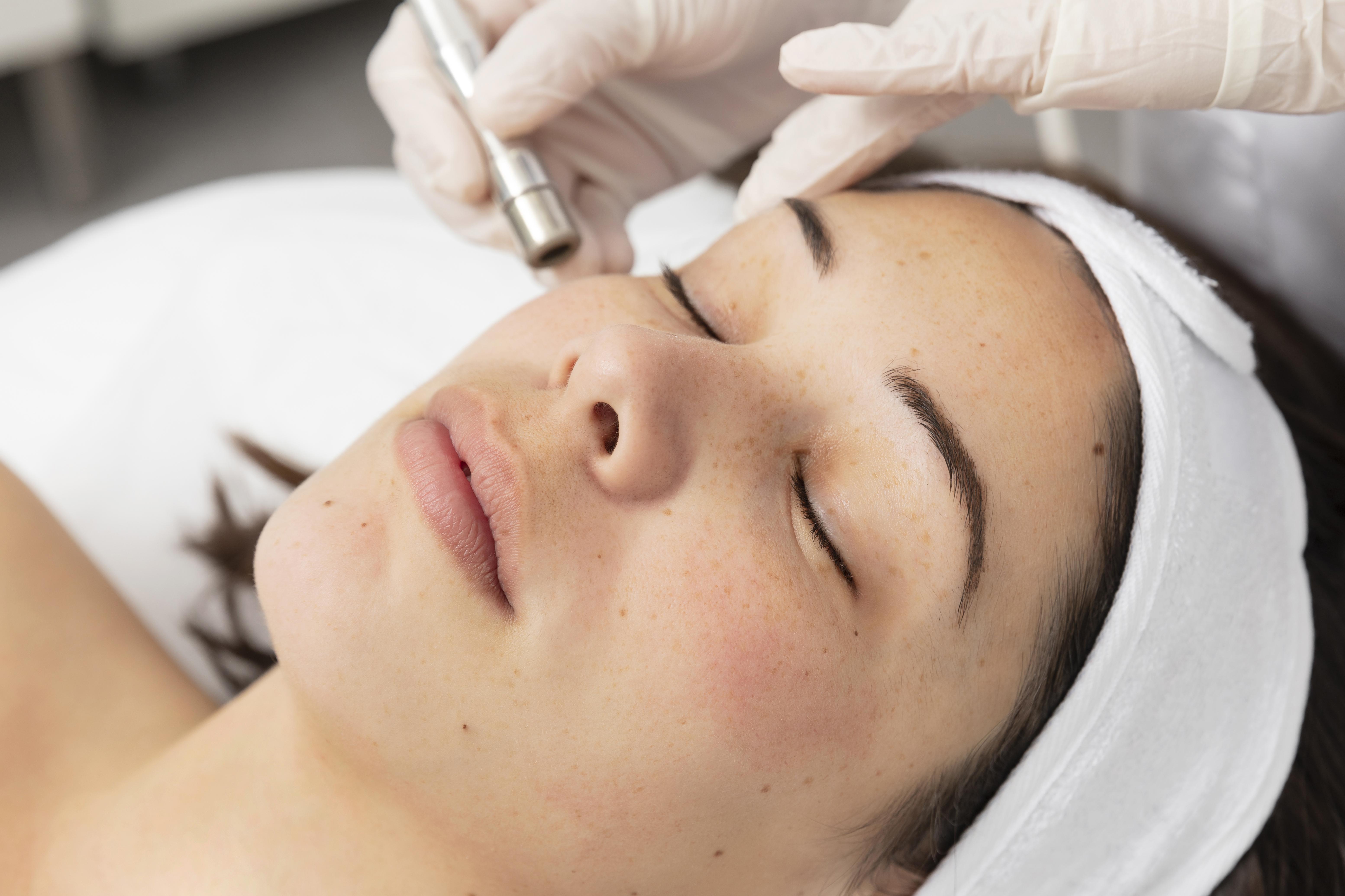 Skin Lightning Treatment In Gurgaon