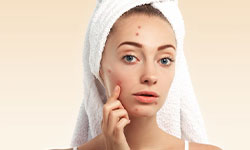 Acne Cleanup