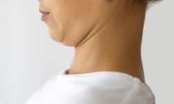 Double Chin