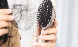 Hair fall treatment