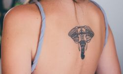 Tattoo Removal